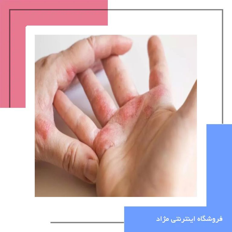 عوارض جانبی و تفاوت های کلیدی دایوبت با سایر داروهای موضعی