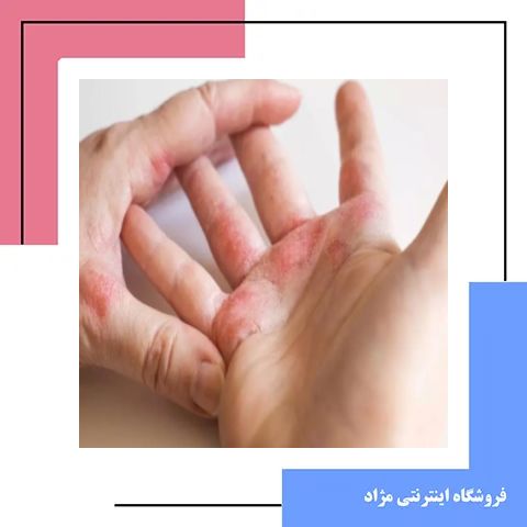 عوارض جانبی و تفاوت های کلیدی دایوبت با سایر داروهای موضعی