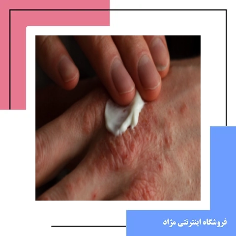 نکات مهم در مصرف و ایمنی پماد دایوبت (Dayobet)؛ راهنمای کامل برای بیماران پسوریازیس