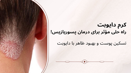 خرید پماد دایوبت